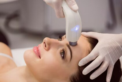 Picosecond lasers use ultra-short pulses to treat skin concerns with precision. (Freepik) Picosecond lasers use ultra-short pulses to treat skin concerns with precision. (Freepik)