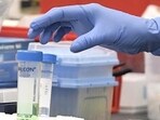 Up to 64 instances of Guillain-Barre syndrome (GBS) have been identified in Maharashtra's Pune district, according to a Pune Municipal Corporation (PMC) Commissioner official.