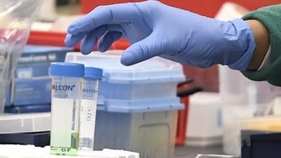 Up to 64 instances of Guillain-Barre syndrome (GBS) have been identified in Maharashtra's Pune district, according to a Pune Municipal Corporation (PMC) Commissioner official. (AI/representative ) Up to 64 instances of Guillain-Barre syndrome (GBS) have been identified in Maharashtra's Pune district, according to a Pune Municipal Corporation (PMC) Commissioner official. (AI/representative )