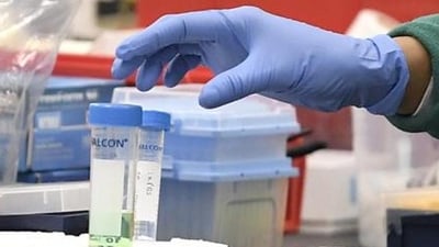 Patients diagnosed with GB syndrome within the jurisdiction of Pune Municipal Corporation would be treated free of cost. (Representational)