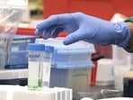 The ICMR chief said the cause or association of GBS is found only in 40 per cent cases. The ICMR chief said the cause or association of GBS is found only in 40 per cent cases.