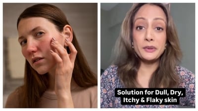Dry skin is a condition caused by a lack of hydration. Nutritionist Mohita Mascarenhas shared some foods that can help improve skin hydration and combat dryness. (PC: Freepik & IG) Dry skin is a condition caused by a lack of hydration. Nutritionist Mohita Mascarenhas shared some foods that can help improve skin hydration and combat dryness. (PC: Freepik & IG)