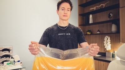 The tech millionaire revealed that he has now upgraded and will no longer inject his son's blood. (X/@bryan_johnson) The tech millionaire revealed that he has now upgraded and will no longer inject his son's blood. (X/@bryan_johnson)