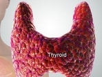 From goiter to cancer: The hidden dangers of untreated thyroid problems. From goiter to cancer: The hidden dangers of untreated thyroid problems.