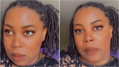 Woman says her jawline transformed after wisdom teeth extraction. (Instagram/@prettyinpeach33) Woman says her jawline transformed after wisdom teeth extraction. (Instagram/@prettyinpeach33)