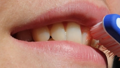 Warnings and remedies for unhealthy teeth. (Image by Pixabay) Warnings and remedies for unhealthy teeth. (Image by Pixabay)