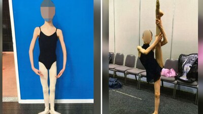 Despite being well into her teens, the girl weighed only 27 kgs when she was hospitalised for being too gaunt. (WA District Court) Despite being well into her teens, the girl weighed only 27 kgs when she was hospitalised for being too gaunt. (WA District Court)