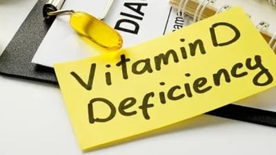 Vitamin D (Unsplash)
