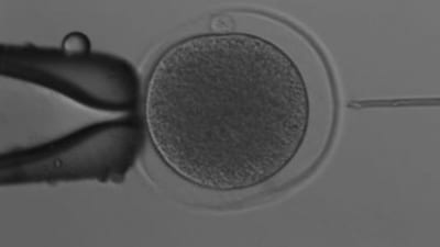 Scientists in Australia achieved a breakthrough by creating kangaroo embryos via IVF (Image credits: University of Queensland.) Scientists in Australia achieved a breakthrough by creating kangaroo embryos via IVF (Image credits: University of Queensland.)