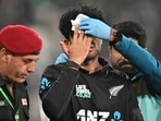 New Zealand's Rachin Ravindra (C) receives medical attention after being hit on the head by the ball during the Tri-Nation's first one-day international cricket match between Pakistan and New Zealand at the Gaddafi Stadium in Lahore. New Zealand's Rachin Ravindra (C) receives medical attention after being hit on the head by the ball during the Tri-Nation's first one-day international cricket match between Pakistan and New Zealand at the Gaddafi Stadium in Lahore.