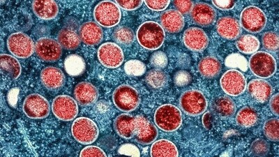 Fly species that were less affected by a certain virus also tended to respond well to related viruses. (AP/File) Fly species that were less affected by a certain virus also tended to respond well to related viruses. (AP/File)