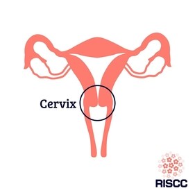 India accounts for the highest number of cervical cancer cases. Watch out for these warning signs (Photo by Twitter/RISCC_H2020)