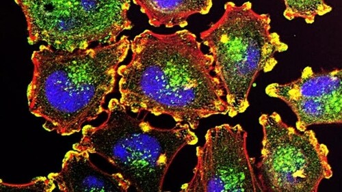 Published in the journal Nature, a study provides new insights into how cancers evolve to adapt to changing environments and suggests ways to reduce drug resistance by combining therapies. (Pixabay) Published in the journal Nature, a study provides new insights into how cancers evolve to adapt to changing environments and suggests ways to reduce drug resistance by combining therapies. (Pixabay)