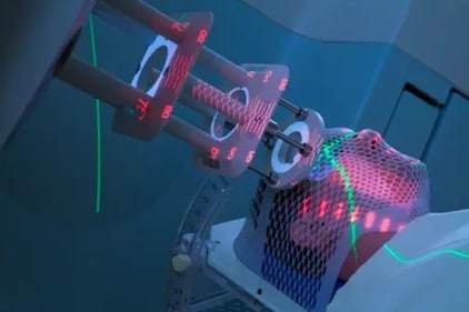 “Radiotherapy is an essential treatment modality in cancer care. It employs high-energy X-ray beams to target and destroy cancer cells," said Dr Prashant Nayak. (Unsplash) “Radiotherapy is an essential treatment modality in cancer care. It employs high-energy X-ray beams to target and destroy cancer cells," said Dr Prashant Nayak. (Unsplash)