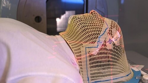 Patient radiation therapy mask showing laser lines for targeting cancer cells in the brain. (Shutterstock) Patient radiation therapy mask showing laser lines for targeting cancer cells in the brain. (Shutterstock)