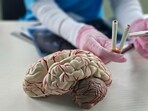 "Repeated exposure to nicotine and carbon monoxide can increase the likelihood of Alzheimer’s disease," said Dr Aashka Ponda. "Repeated exposure to nicotine and carbon monoxide can increase the likelihood of Alzheimer’s disease," said Dr Aashka Ponda.