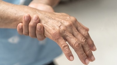 “Guillain-Barre syndrome is one of the relatively infrequent causes for paralysis due to damage to the peripheral nerves," said Dr Rajesh B Iyer. (Shutterstock) “Guillain-Barre syndrome is one of the relatively infrequent causes for paralysis due to damage to the peripheral nerves," said Dr Rajesh B Iyer. (Shutterstock)