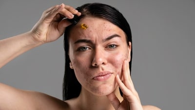 Explore effective skincare routine to combat pigmentation and achieve radiant skin. (Freepik) Explore effective skincare routine to combat pigmentation and achieve radiant skin. (Freepik)
