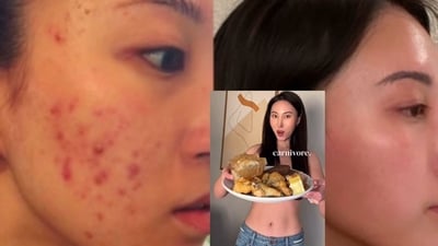 Bella claimed that she no longer uses sunscreen. (Instagram/@steakandbuttergal) Bella claimed that she no longer uses sunscreen. (Instagram/@steakandbuttergal)