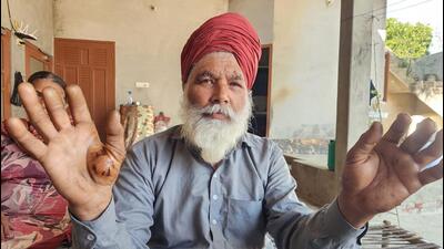 Jagdeep Singh of Bhisiana village in Bathinda showing injury marks from the wild on Friday (HT Photo) Jagdeep Singh of Bhisiana village in Bathinda showing injury marks from the wild on Friday (HT Photo)