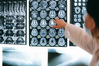 A study identified special neurons that can differentiate between new and familiar objects. (Pexels) A study identified special neurons that can differentiate between new and familiar objects. (Pexels)