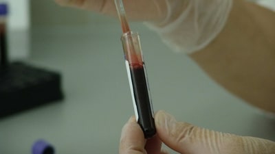 New blood cancer treatment offers hope for 600 patients annually in England. (Pixabay) New blood cancer treatment offers hope for 600 patients annually in England. (Pixabay)