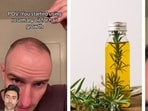 Rosemary boosts hair growth.