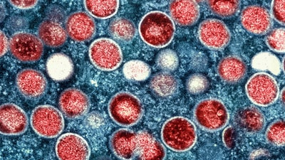 HKU5-CoV-2 shares similarities with COVID-19 as well as the virus that causes Middle East Respiratory Syndrome (MERS) (AP/File)