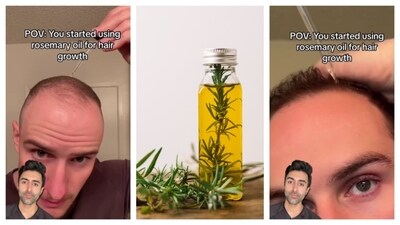Rosemary boosts hair growth. (PC: IG/@doctorsood & Freepik) Rosemary boosts hair growth. (PC: IG/@doctorsood & Freepik)