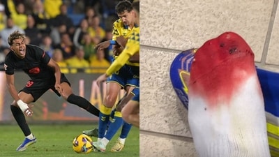 Lamine Yamal posted a photo of his bloodied foot on Instagram. (AFP/ Instagram @lamineyamal)