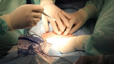 A doctor in Karnataka allegedly left a surgical mop inside the stomach after surgery. (Representational) A doctor in Karnataka allegedly left a surgical mop inside the stomach after surgery. (Representational)