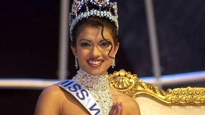 Priyanka Chopra burnt herself with a curling iron right before the Miss World 2000 pageant. Priyanka Chopra burnt herself with a curling iron right before the Miss World 2000 pageant.