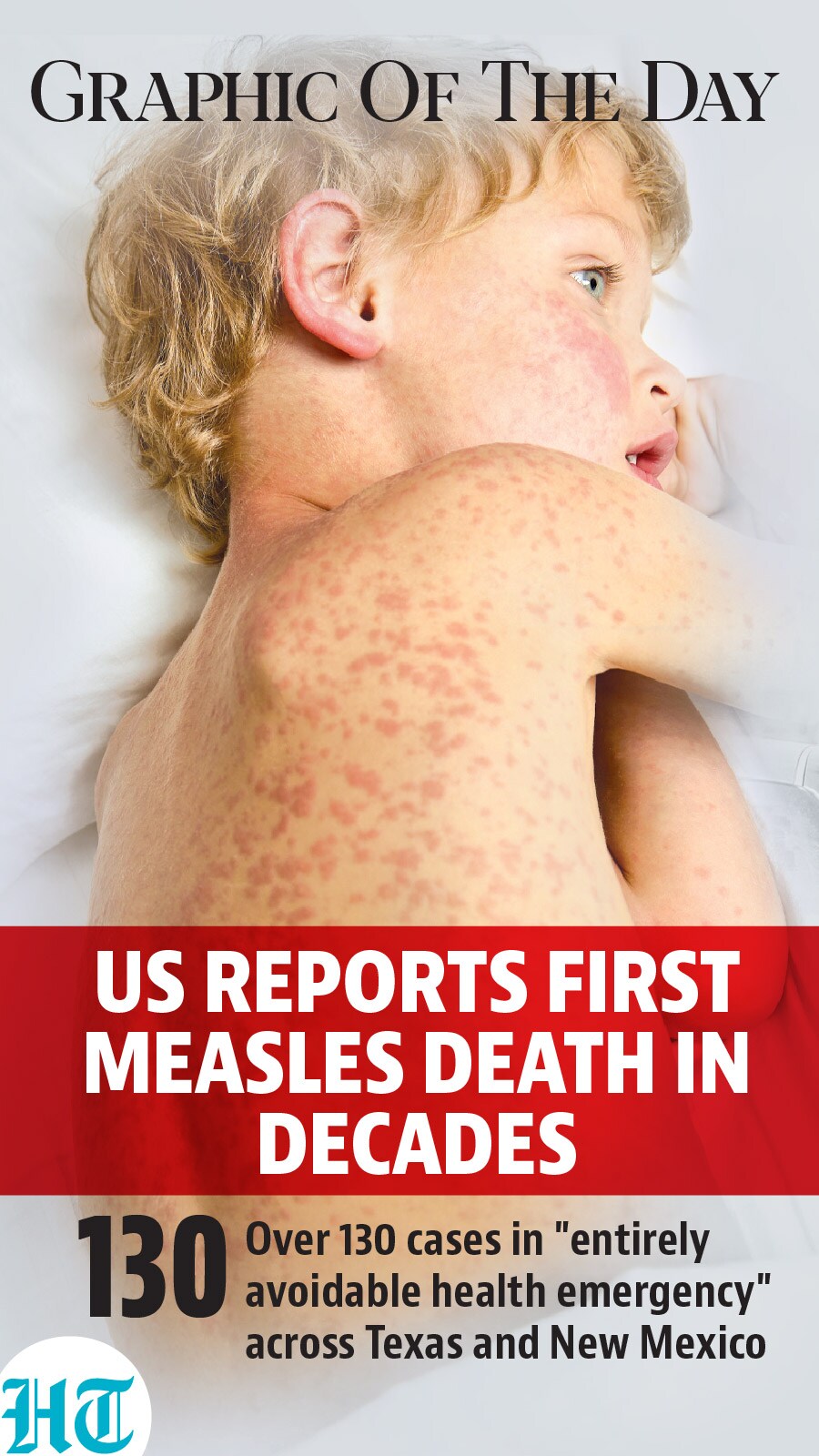 US Measles death US Measles death