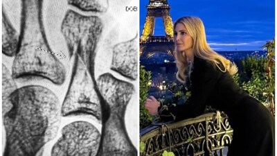 Ivanka Trump's name and birthdate were displayed in the February 23 X-ray. (Ivanka Trump/Instagram) Ivanka Trump's name and birthdate were displayed in the February 23 X-ray. (Ivanka Trump/Instagram)