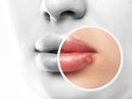 The study states that herpes virus can hijack the immune system responsible to fight it, and cause reactivation. 