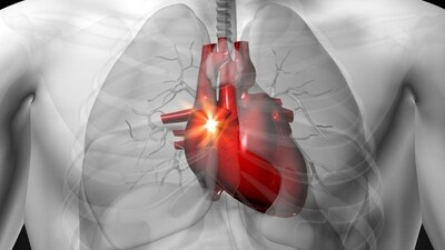 One simple habit could be destroying your heart valves. Fix it now! (File Photo) One simple habit could be destroying your heart valves. Fix it now! (File Photo)