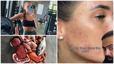 Women goes on carnivore diet to get abs and lose fat, gets health complications instead. (@drkaranrajan, shutterstrock) Women goes on carnivore diet to get abs and lose fat, gets health complications instead. (@drkaranrajan, shutterstrock)