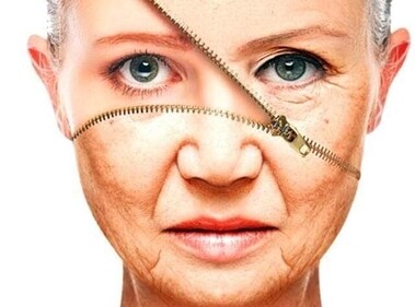 If age spots are bothering you, you could go in for laser therapy or IPL (Intense Pulsed Light) to get back smoother, even-toned and younger looking skin. (Shutterstock) If age spots are bothering you, you could go in for laser therapy or IPL (Intense Pulsed Light) to get back smoother, even-toned and younger looking skin. (Shutterstock)