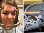After suffering severe facial pain, Nicola Shaw discovered she had a meningioma, a rare brain tumor. After suffering severe facial pain, Nicola Shaw discovered she had a meningioma, a rare brain tumor.