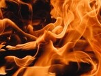 A brush fire is spreading and threatening a car dealership on Capitol Drive & Barker Road in Brookfield, Wisconsin. A brush fire is spreading and threatening a car dealership on Capitol Drive & Barker Road in Brookfield, Wisconsin.