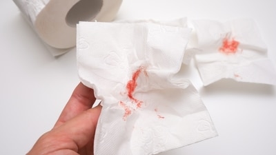 Too much bleeding can be an early sign of liver damage. (Shutterstock) Too much bleeding can be an early sign of liver damage. (Shutterstock)