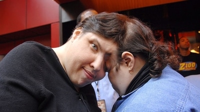 Lori and George Schappell were conjoined twins born in 1961, (X/@Mitchal01)