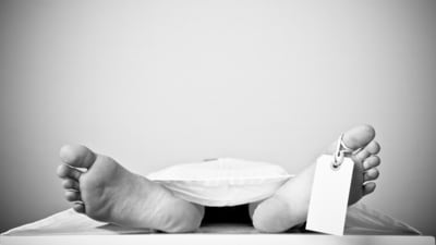 Doctors said the deceased's condition is suspected to be linked to anorexia nervosa, a severe eating disorder. (Representative/Shutterstock) Doctors said the deceased's condition is suspected to be linked to anorexia nervosa, a severe eating disorder. (Representative/Shutterstock)