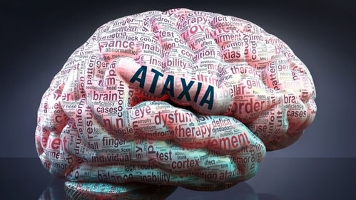 Know the types and earning signs of ataxia. (Shutterstock) Know the types and earning signs of ataxia. (Shutterstock)