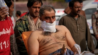 Pakistan train hijack: An injured passenger rescued by security forces from a passenger train attacked by insurgents arrive at a railway station in Much near Quetta. (AP) Pakistan train hijack: An injured passenger rescued by security forces from a passenger train attacked by insurgents arrive at a railway station in Much near Quetta. (AP)