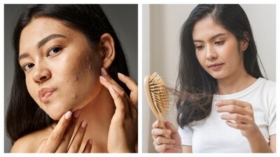Skin and hair are most affected by poor lifestyle choices. (Shutterstock) Skin and hair are most affected by poor lifestyle choices. (Shutterstock)