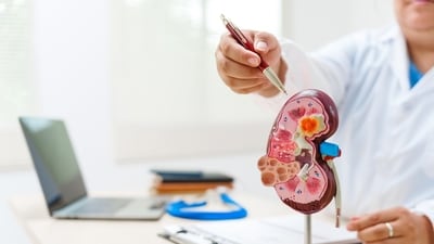 When kidney functions drop to a critical level, usually dialysis or kidney transplant is suggested by health experts. (Shutterstock) When kidney functions drop to a critical level, usually dialysis or kidney transplant is suggested by health experts. (Shutterstock)