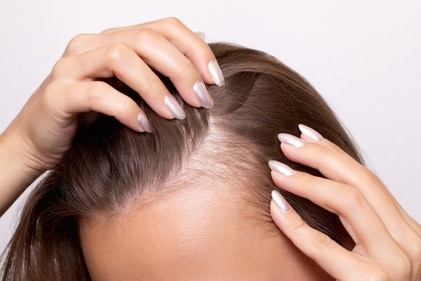 Hair thinning is one of the major concerns women are facing today. (Shutterstock) Hair thinning is one of the major concerns women are facing today. (Shutterstock)