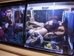 An injured train passenger is being transported following an operation against armed militants who ambushed the train in the remote mountainous area in Mach, southwestern Balochistan province on March 12, 2025. An injured train passenger is being transported following an operation against armed militants who ambushed the train in the remote mountainous area in Mach, southwestern Balochistan province on March 12, 2025.