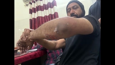 Colonel Pushpinder Bath, who is currently posted at the army headquarters in New Delhi, claimed he was assaulted on the intervening night of March 13 and 14. He is currently undergoing treatment at a hospital. (HT Photo)